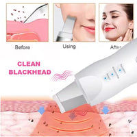Limpiador Facial Recargable Para Exfoliacion Y Hidratacion