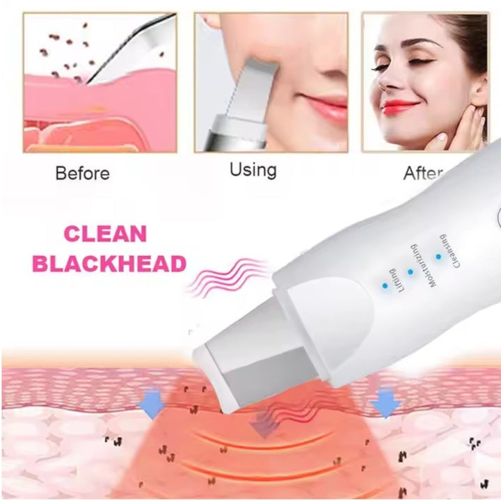 Limpiador Facial Recargable Para Exfoliacion Y Hidratacion