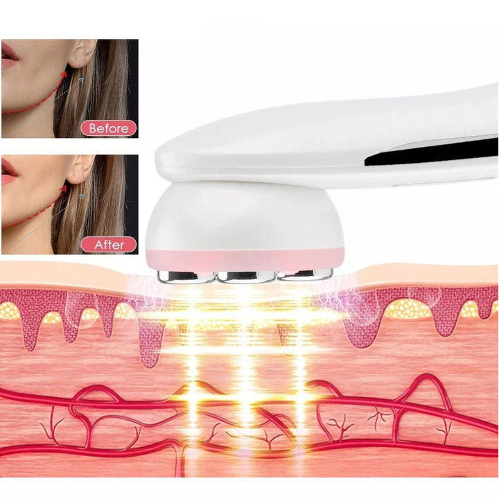 Radio Frecuencia Facial para Rejuvenecer y Tensar la Piel